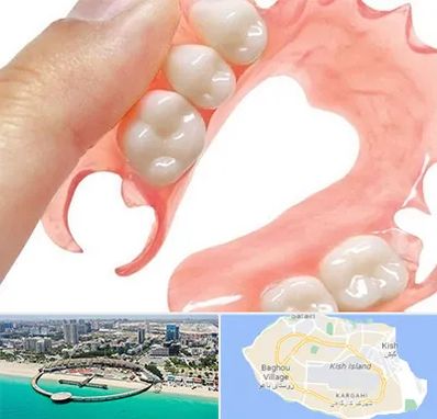 پروتز متحرک دندان در کیش
