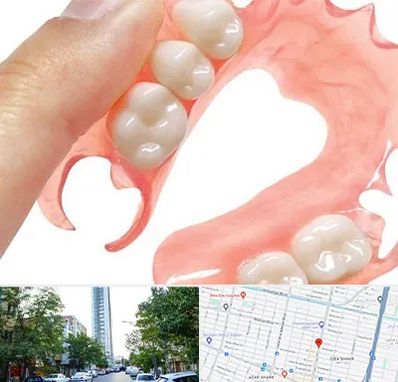 پروتز متحرک دندان در امامت مشهد 