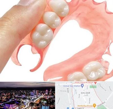 پروتز متحرک دندان در گلسار رشت 