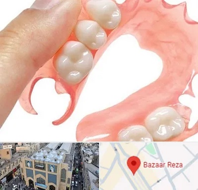 پروتز متحرک دندان در بازار رضا مشهد