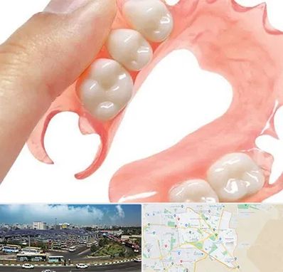 پروتز متحرک دندان در منطقه 15 تهران 