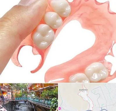 پروتز متحرک دندان در درکه