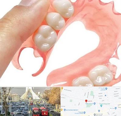 پروتز متحرک دندان در خیابان آزادی 