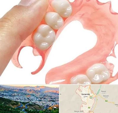 پروتز متحرک دندان در سنندج