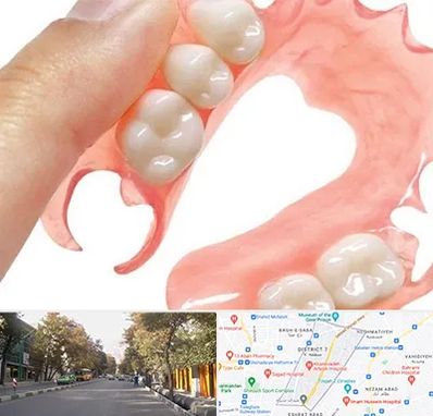 پروتز متحرک دندان در شریعتی 