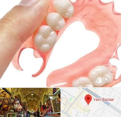 پروتز متحرک دندان در بازار وکیل شیراز