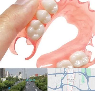 پروتز متحرک دندان در توانیر