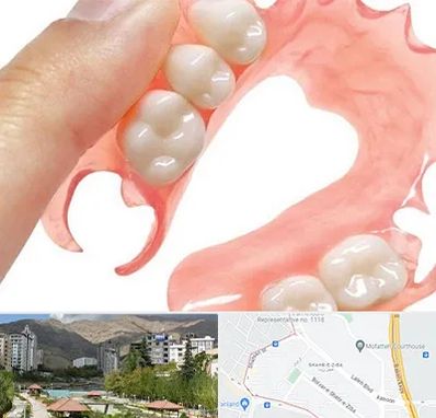 پروتز متحرک دندان در شهر زیبا 