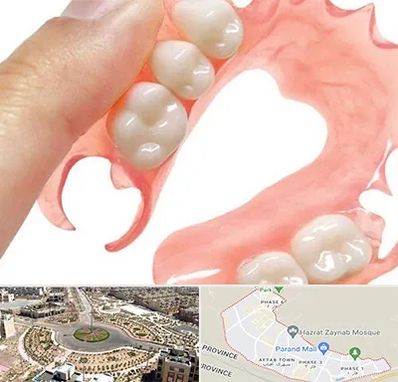 پروتز متحرک دندان در پرند