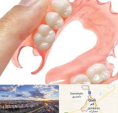 پروتز متحرک دندان در قم