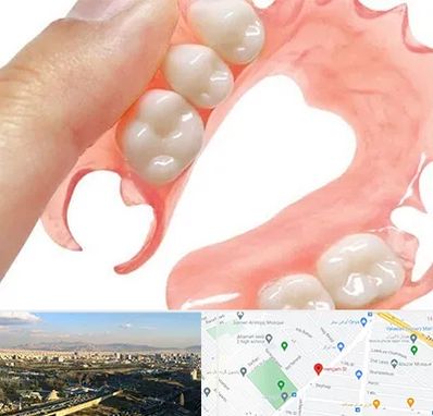 پروتز متحرک دندان در هنگام 