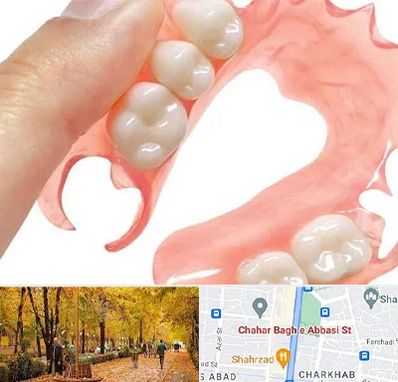 پروتز متحرک دندان در چهارباغ اصفهان 