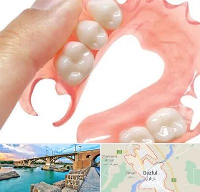 پروتز متحرک دندان در دزفول