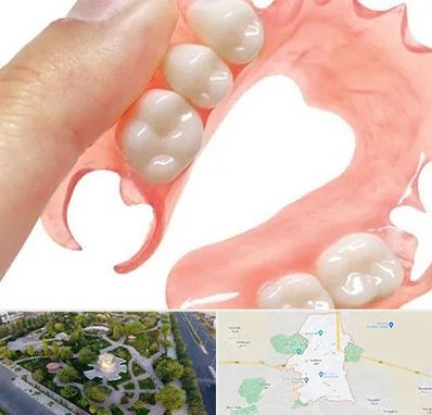 پروتز متحرک دندان در کاشمر