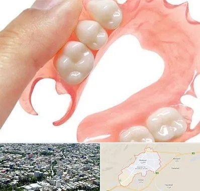 پروتز متحرک دندان در شاهرود