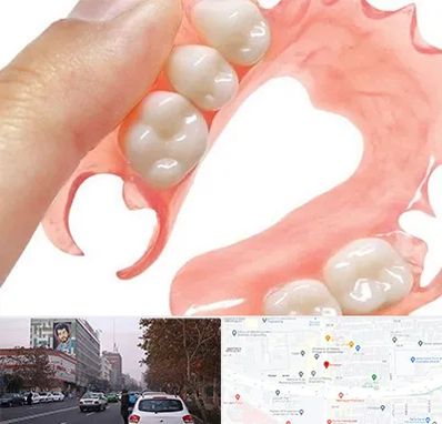 پروتز متحرک دندان در کارگر شمالی 