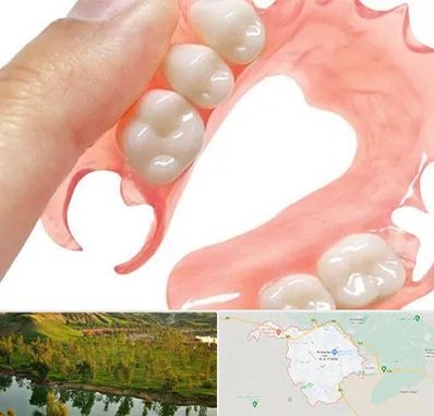 پروتز متحرک دندان در بهبهان