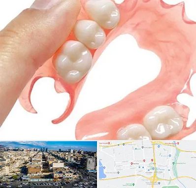 پروتز متحرک دندان در شهرک راه آهن 