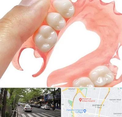 پروتز متحرک دندان در ظفر 