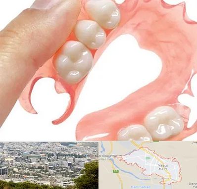 پروتز متحرک دندان در یاسوج
