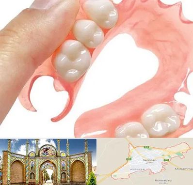 پروتز متحرک دندان در سمنان