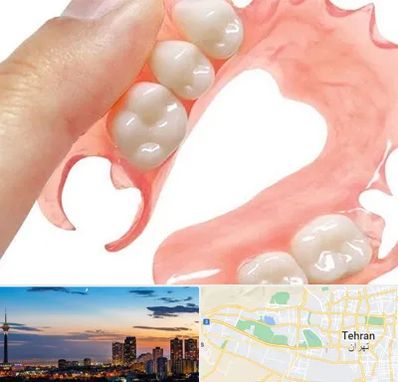 پروتز متحرک دندان در غرب تهران 