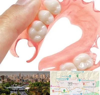 پروتز متحرک دندان در منطقه 1 تهران 