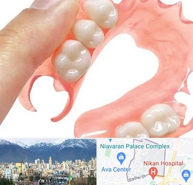 پروتز متحرک دندان در آجودانیه 