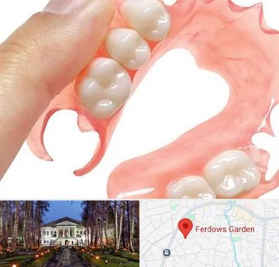 پروتز متحرک دندان در باغ فردوس