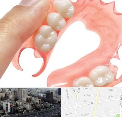 پروتز متحرک دندان در زرتشت