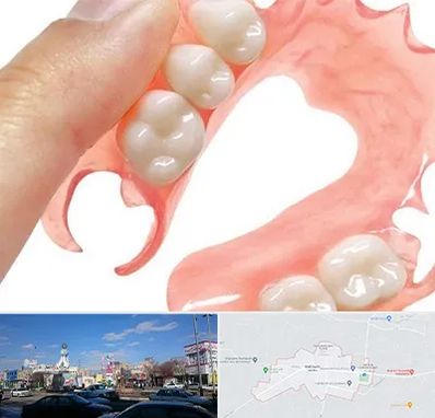 پروتز متحرک دندان در ماهدشت کرج 