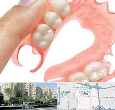 پروتز متحرک دندان در آپادانا