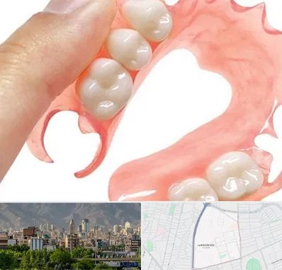 پروتز متحرک دندان در جمشیدیه