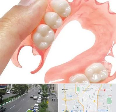 پروتز متحرک دندان در ستارخان 