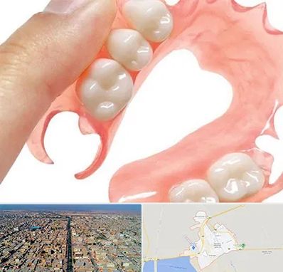 پروتز متحرک دندان در بندر ماهشهر