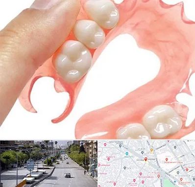 پروتز متحرک دندان در خیابان زند شیراز 