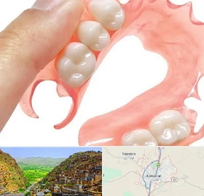 پروتز متحرک دندان در کامیاران