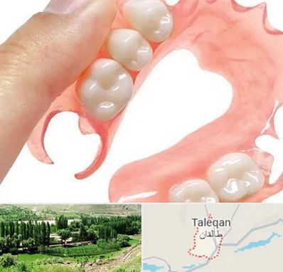 پروتز متحرک دندان در طالقان