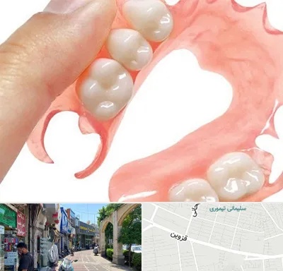 پروتز متحرک دندان در خیابان قزوین