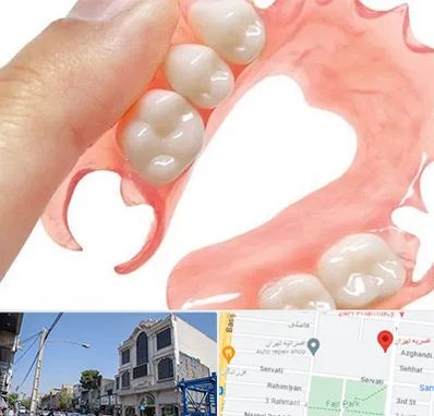 پروتز متحرک دندان در افسریه 