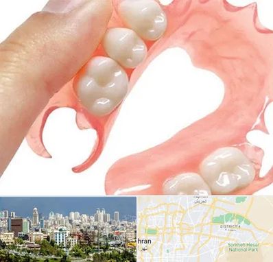 پروتز متحرک دندان در شرق تهران 