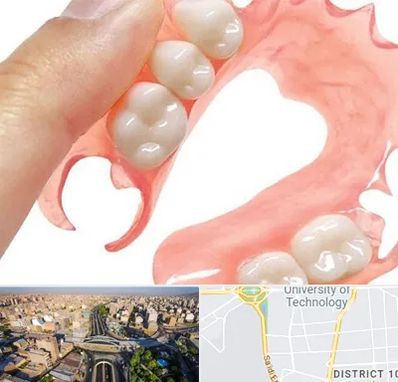 پروتز متحرک دندان در استاد معین 