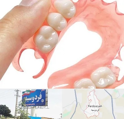 پروتز متحرک دندان در فردوسیه شهریار