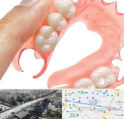 پروتز متحرک دندان در فرجام 