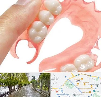 پروتز متحرک دندان در خیابان ارم شیراز 