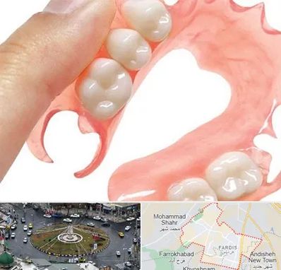 پروتز متحرک دندان در فردیس کرج 