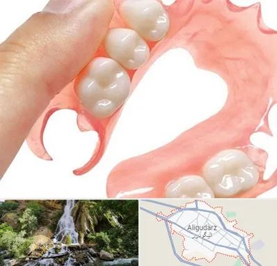 پروتز متحرک دندان در الیگودرز