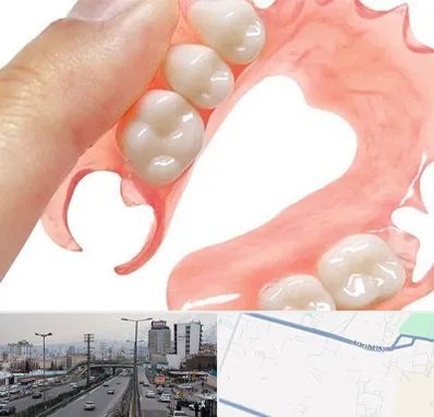 پروتز متحرک دندان در بلوار ارتش