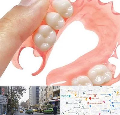 پروتز متحرک دندان در فاطمی 