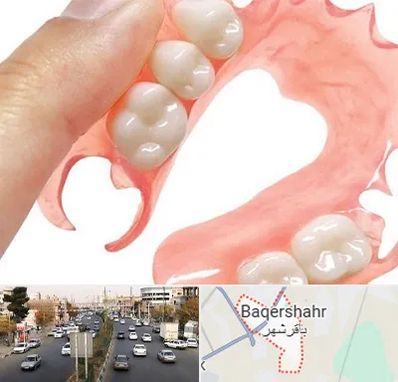 پروتز متحرک دندان در باقرشهر